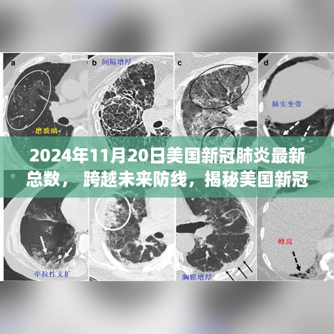 揭秘美国新冠肺炎最新科技进展与体验之旅，2024年数据报告出炉！