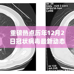 重磅热点，历年12月2日冠状病毒最新动态深度解析