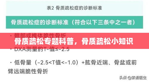 骨质疏松专题科普，骨质疏松小知识 