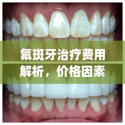 氟斑牙治疗费用解析，价格因素全解析