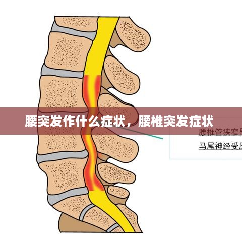 腰突发作什么症状，腰椎突发症状 